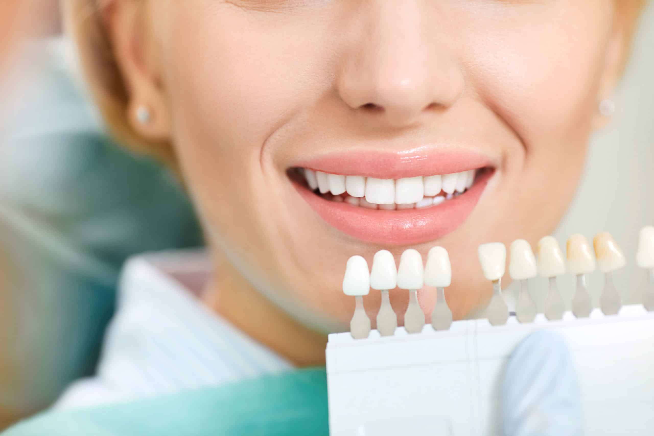 Female patient smiling with artificial teeth samples